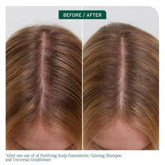 Biolage Scalp Sync Calming Shampoo - Gently Cleanses Dry & Sensitive Scalps, Hydrates & Soothes, Fermented Tea Blend & Glycolic Acid, Vegan & Paraben-Free