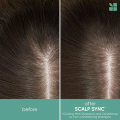 Biolage Scalp Sync Conditioner | Weightlessly Soothes & Nourishes To Promote A Healthy-Looking Scalp | Paraben Free | For All Hair Types | Cruelty Free | Vegan | Salon Conditioner
