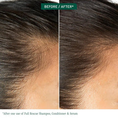 Biolage Full Rescue Invigorating Serum - for Stronger Hair, Longer Lengths in 4 weeks*, Balances Scalp & Fortifies Strands at the Root, Rosemary Oil & Niacinamide, Vegan & Paraben-Free, 1.6 Fl Oz