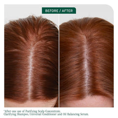 Biolage Scalp Sync Clarifying Shampoo & Universal Conditioner Set - Removes Residue, Buildup & Excess Oil, Paraben & Silicone-Free, For Oily Hair & Scalp, Vegan, 33.8 Fl Oz