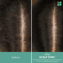 Biolage Scalp Sync Anti-Dandruff Shampoo & Conditioner Set | Targets Dandruff, Controls The Appearance of Flakes & Relieves Scalp Irritation | For Dandruff Control | Paraben-Free | Vegan