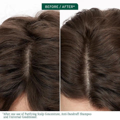 Biolage Scalp Sync Anti-Dandruff Shampoo & Universal Conditioner Set - Targets Dandruff, Controls The Appearance of Flakes & Relieves Scalp Irritation, Scalp Treatment System, Paraben-Free, Vegan